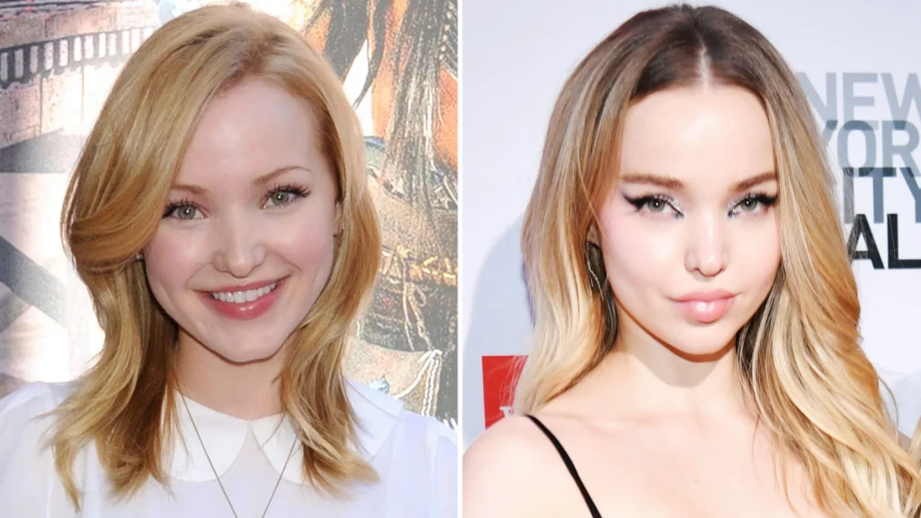 Dove Cameron Before Plastic Surgery