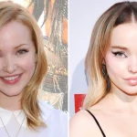 Dove Cameron Before Plastic Surgery