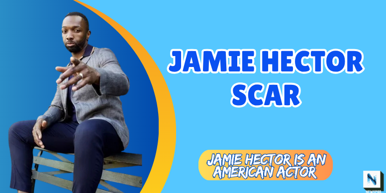 jamie hector scar